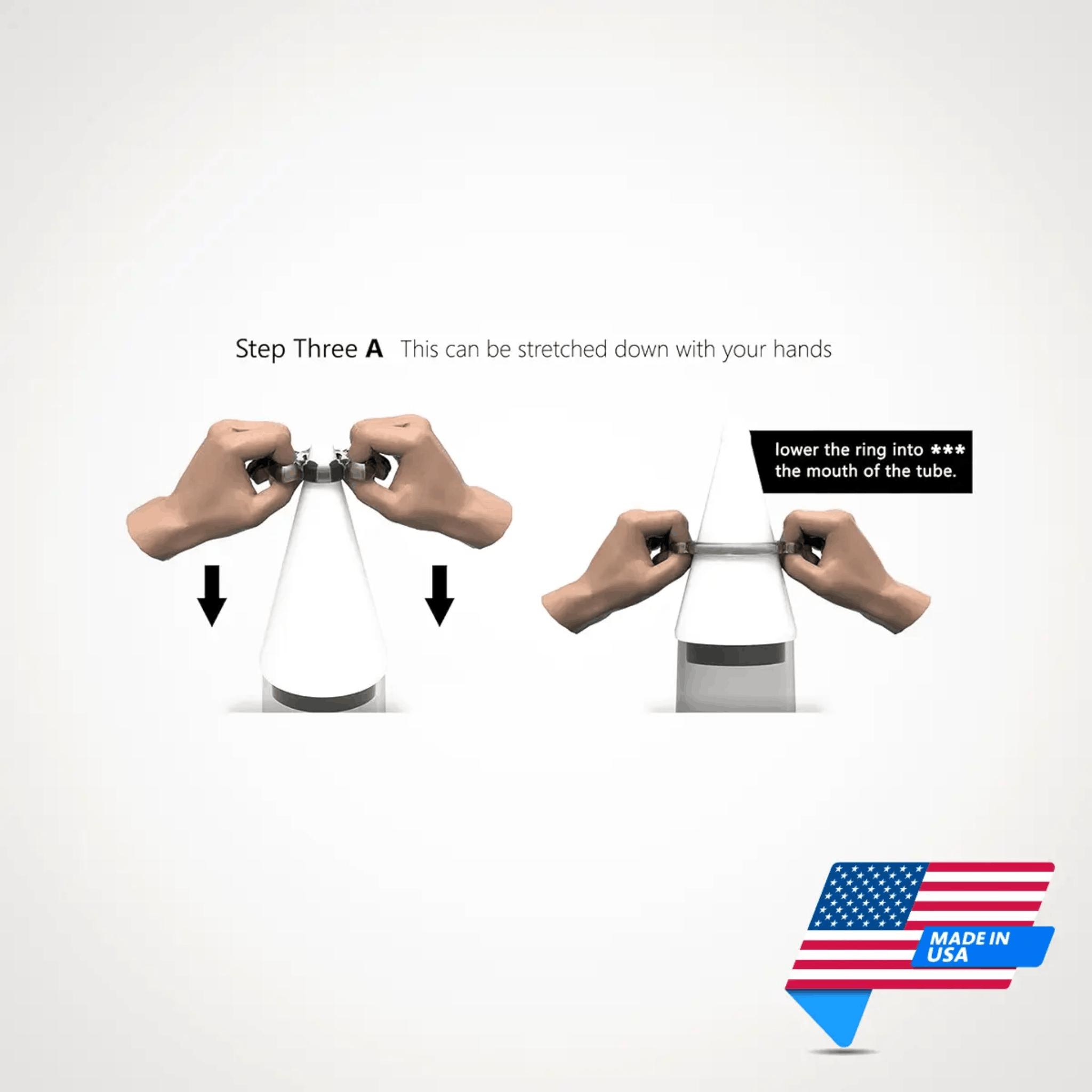 Morpheus® Constriction Rings